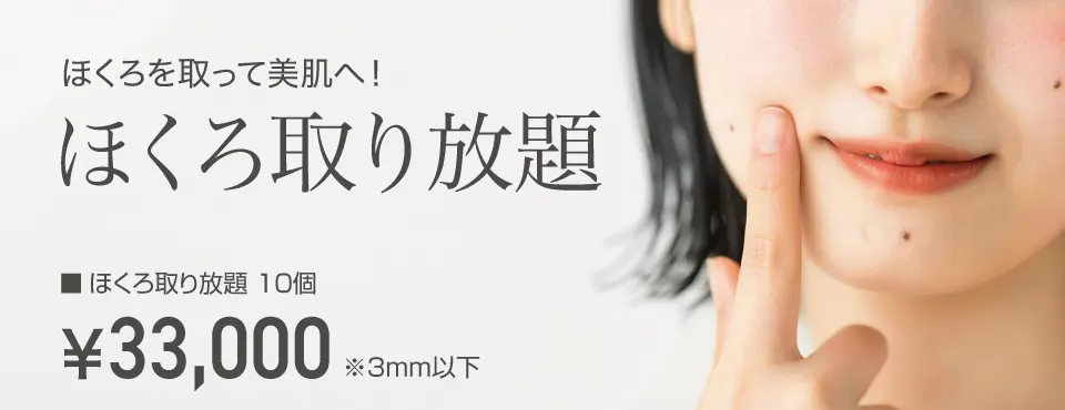ホクロ取り放題
